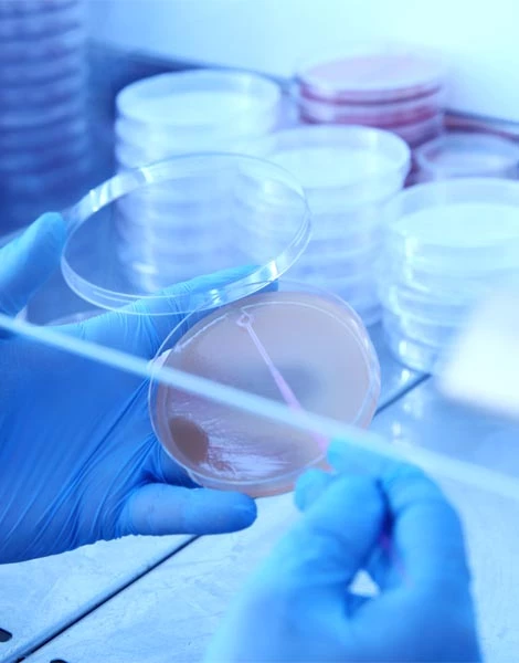 Gıda Mikrobiyolojik Analizleri